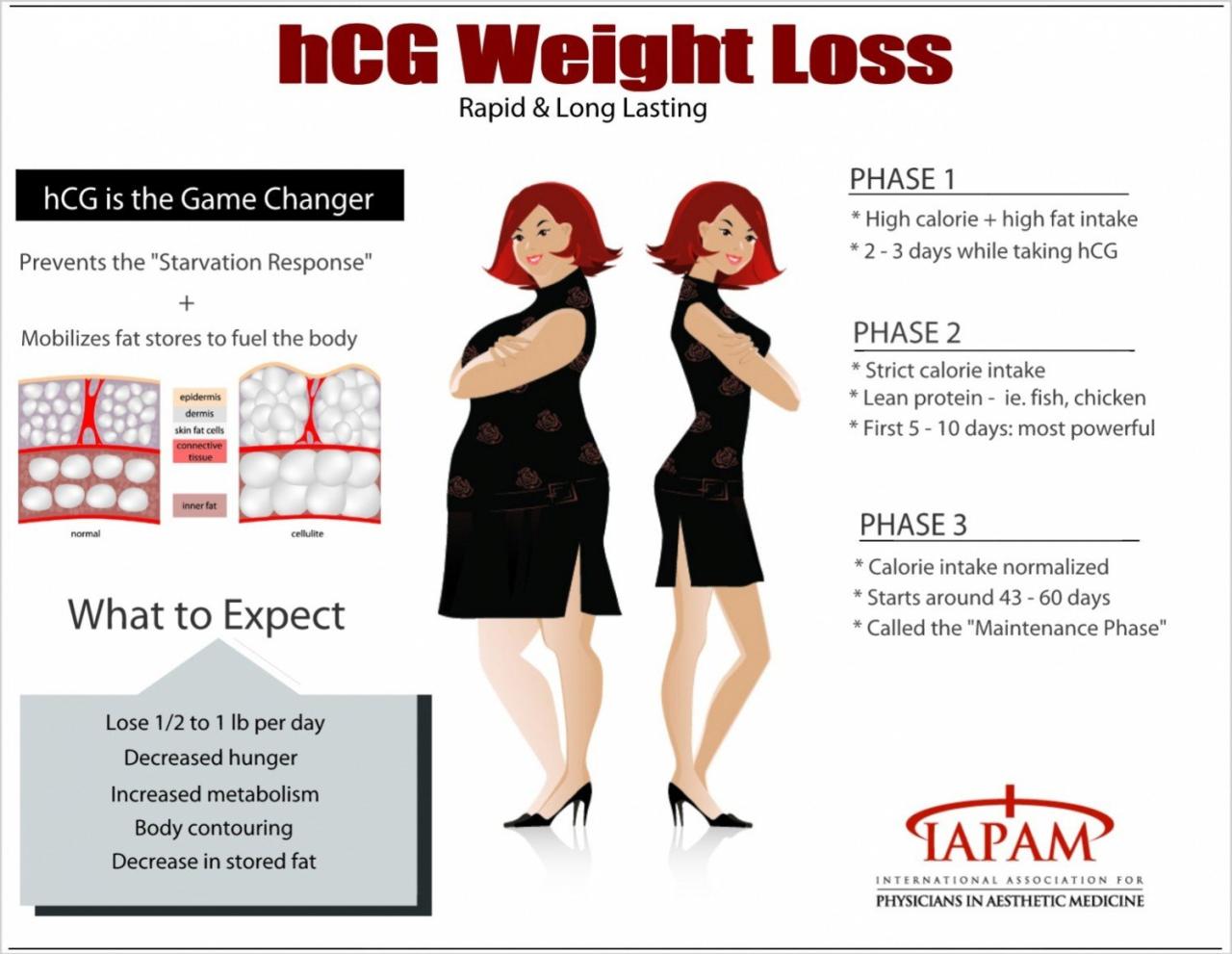 104 lb Weight Loss with the hCG Diet Protocol – hCG Diet Interviews ...